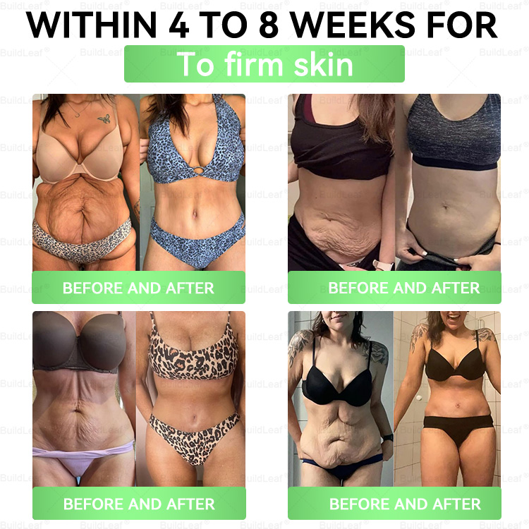 X 𝐎𝐟𝐟𝐢𝐜𝐢𝐚𝐥 𝐒𝐭𝐨𝐫𝐞 | 𝘽𝙪𝙞𝙡𝙙𝙇𝙚𝙖𝙛® 𝗚𝗟𝗣-𝟭 𝟐𝟎-𝐢𝐧-𝟏 𝐒𝐥𝐢𝐦 & 𝐇𝐞𝐚𝐥𝐭𝐡 𝐎𝐫𝐚𝐥 𝐒𝐨𝐥𝐮𝐭𝐢𝐨𝐧 (𝑶𝒏𝒄𝒆 𝒂 𝒅𝒂𝒚,𝒓𝒆𝒔𝒖𝒍𝒕𝒔 𝒊𝒏 7 𝒅𝒂𝒚𝒔),𝑾𝒊𝒕𝒉 100 𝑩𝒊𝒍𝒍𝒊𝒐𝒏 𝑪𝑭𝑼 𝑨𝒄𝒕𝒊𝒗𝒆 𝑷𝒓𝒐𝒃𝒊𝒐𝒕𝒊𝒄𝒔✅𝑺𝒖𝒑𝒑𝒐𝒓𝒕𝒔 𝒘𝒆𝒊𝒈𝒉𝒕 𝒎𝒂𝒏𝒂𝒈𝒆𝒎𝒆𝒏𝒕,𝒉𝒆𝒂𝒓𝒕 𝒉𝒆𝒂𝒍𝒕𝒉,𝒅𝒊𝒂𝒃𝒆𝒕𝒆𝒔,𝒈𝒖𝒕 & 𝒘𝒐𝒎𝒆𝒏’𝒔 𝒉𝒆𝒂𝒍𝒕𝒉,𝒘𝒉𝒊𝒍𝒆 𝒇𝒊𝒓𝒎𝒊𝒏𝒈 𝒔𝒌𝒊𝒏 & 𝒃𝒐𝒐𝒔𝒕𝒊𝒏𝒈 𝒆𝒏𝒆𝒓𝒈𝒚.