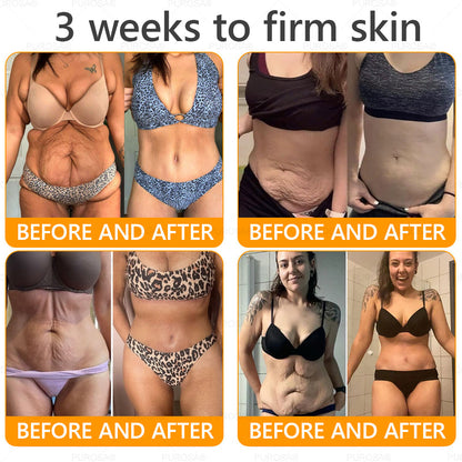 Official U.S. Store🌸PUROSA® Bee Venom Comprehensive Cream🔥LAST DAY: 80% OFF (For sagging skin, fine lines, loss of firmness, flat bust, drooping hips, and more)