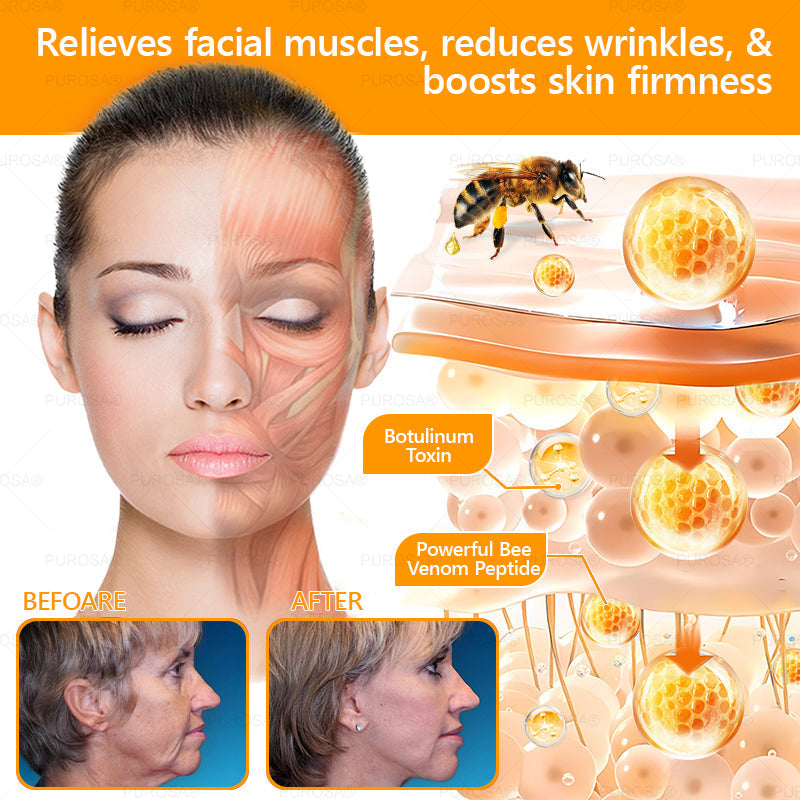 Official U.S. Store🌸PUROSA® Bee Venom Comprehensive Cream🔥LAST DAY: 80% OFF (For sagging skin, fine lines, loss of firmness, flat bust, drooping hips, and more)