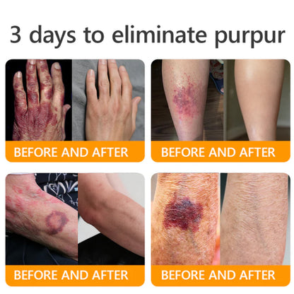 Official U.S. Store🌸PUROSA® Bee Venom Comprehensive Cream🔥LAST DAY: 80% OFF (For sagging skin, fine lines, loss of firmness, flat bust, drooping hips, and more)