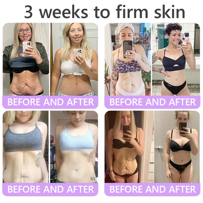 𝑭𝑫𝑨 𝑶𝒇𝒇𝒊𝒄𝒊𝒂𝒍: 𝐇𝐈𝐒𝐊𝐈𝐍® 𝑷𝑫𝑹𝑵 𝑴𝒖𝒍𝒕𝒊-𝑷𝒆𝒑𝒕𝒊𝒅𝒆 𝑴𝒂𝒔𝒔𝒂𝒈𝒊𝒏𝒈 𝑩𝒐𝒅𝒚 𝑹𝒐𝒍𝒍𝒆𝒓 𝗖𝗿𝗲𝗮𝗺- 𝗔𝗻𝘁𝗶-𝗮𝗴𝗶𝗻𝗴, 𝗛𝘆𝗱𝗿𝗮𝘁𝗶𝗻𝗴,𝗦𝗸𝗶𝗻 𝗙𝗶𝗿𝗺𝗶𝗻𝗴 & 𝗟𝗶𝗳𝘁𝗶𝗻𝗴, 𝗦𝗸𝗶𝗻 𝗥𝗲𝗽𝗮𝗶𝗿, 𝗘𝘃𝗲𝗻 𝗧𝗼𝗻𝗲, 𝗔𝗰𝗻𝗲 𝗮𝗻𝗱 𝗗𝗮𝗿𝗸 𝗦𝗽𝗼𝘁 𝗧𝗿𝗲𝗮𝘁𝗺𝗲𝗻𝘁, 𝗪𝗮𝗿𝘁 𝗮𝗻𝗱 𝗠𝗼𝗹𝗲 𝗥𝗲𝗺𝗼𝘃𝗮𝗹, 𝗮𝗻𝗱 𝗣𝘀𝗼𝗿𝗶𝗮𝘀𝗶𝘀 𝗥𝗲𝗹𝗶𝗲𝗳.