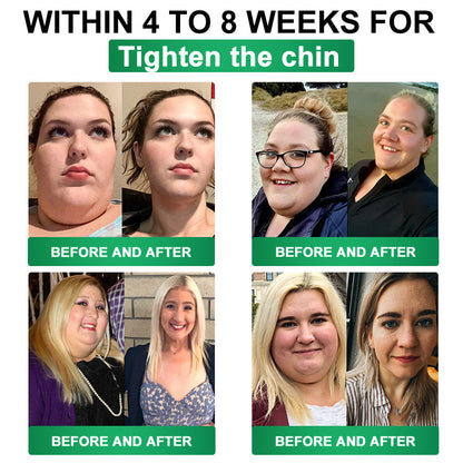𝑪𝒂𝒓𝒆𝑼𝒑𝒍𝒊𝒇𝒕® 𝗠𝗼𝗿𝗶𝗻𝗴𝗮 · 𝗕𝗲𝗿𝗯𝗲𝗿𝗶𝗻𝗲 × 𝗡𝗔𝗗+ 𝟏𝟎-𝐢𝐧-𝟏 𝐀𝐝𝐯𝐚𝐧𝐜𝐞𝐝 𝐍𝐚𝐧𝐨 𝐌𝐢𝐜𝐫𝐨𝐧𝐞𝐞𝐝𝐥𝐞 𝐏𝐚𝐭𝐜𝐡 — 𝙾𝚗𝚌𝚎 𝙳𝚊𝚒𝚕𝚢, 𝚅𝚒𝚜𝚒𝚋𝚕𝚎 𝚁𝚎𝚜𝚞𝚕𝚝𝚜 𝚒𝚗 𝟽 𝙳𝚊𝚢𝚜✅ ғᴏʀ ᴏʙᴇsɪᴛʏ, ʟᴏᴏsᴇ sᴋɪɴ, ᴅɪᴀʙᴇᴛᴇs, sʟᴇᴇᴘ ᴀᴘɴᴇᴀ, ᴊᴏɪɴᴛ ɪssᴜᴇs, ᴀɴᴅ ᴍᴏʀᴇ💯💯