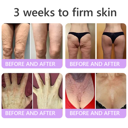 𝑭𝑫𝑨 𝑶𝒇𝒇𝒊𝒄𝒊𝒂𝒍: 𝐇𝐈𝐒𝐊𝐈𝐍® 𝑷𝑫𝑹𝑵 𝑴𝒖𝒍𝒕𝒊-𝑷𝒆𝒑𝒕𝒊𝒅𝒆 𝑴𝒂𝒔𝒔𝒂𝒈𝒊𝒏𝒈 𝑩𝒐𝒅𝒚 𝑹𝒐𝒍𝒍𝒆𝒓 𝗖𝗿𝗲𝗮𝗺- 𝗔𝗻𝘁𝗶-𝗮𝗴𝗶𝗻𝗴, 𝗛𝘆𝗱𝗿𝗮𝘁𝗶𝗻𝗴,𝗦𝗸𝗶𝗻 𝗙𝗶𝗿𝗺𝗶𝗻𝗴 & 𝗟𝗶𝗳𝘁𝗶𝗻𝗴, 𝗦𝗸𝗶𝗻 𝗥𝗲𝗽𝗮𝗶𝗿, 𝗘𝘃𝗲𝗻 𝗧𝗼𝗻𝗲, 𝗔𝗰𝗻𝗲 𝗮𝗻𝗱 𝗗𝗮𝗿𝗸 𝗦𝗽𝗼𝘁 𝗧𝗿𝗲𝗮𝘁𝗺𝗲𝗻𝘁, 𝗪𝗮𝗿𝘁 𝗮𝗻𝗱 𝗠𝗼𝗹𝗲 𝗥𝗲𝗺𝗼𝘃𝗮𝗹, 𝗮𝗻𝗱 𝗣𝘀𝗼𝗿𝗶𝗮𝘀𝗶𝘀 𝗥𝗲𝗹𝗶𝗲𝗳.