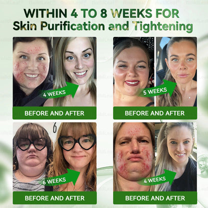 A  𝐵𝑢𝑖𝑙𝑑𝐿𝑒𝑎𝑓® 𝗚𝗟𝗣-𝟭 𝟳 𝗗𝗮𝘆𝘀 𝗚𝘂𝘁 𝗖𝗹𝗲𝗮𝗻𝘀𝗲 & 𝗦𝗹𝗶𝗺 𝗦𝘂𝗽𝗽𝗼𝗿𝘁 𝗢𝗿𝗮𝗹 𝗦𝗼𝗹𝘂𝘁𝗶𝗼𝗻 for Digestive Cleanse ,𝑶𝒃𝒆𝒔𝒊𝒕𝒚, 𝑴𝒆𝒏𝒕𝒂𝒍 𝑪𝒍𝒂𝒓𝒊𝒕𝒚,𝑫𝒊𝒂𝒃𝒆𝒕𝒆𝒔, 𝑫𝒊𝒈𝒆𝒔𝒕𝒊𝒗𝒆 & 𝑪𝒂𝒓𝒅𝒊𝒐𝒗𝒂𝒔𝒄𝒖𝒍𝒂𝒓 𝑯𝒆𝒂𝒍𝒕𝒉, 𝑱𝒐𝒊𝒏𝒕 𝑺𝒖𝒑𝒑𝒐𝒓𝒕, 𝑺𝒌𝒊𝒏 𝑭𝒊𝒓𝒎𝒊𝒏𝒈, 𝑨𝒏𝒕𝒊-𝑨𝒈𝒊𝒏𝒈, 𝑺𝒕𝒓𝒆𝒔𝒔 𝑹𝒆𝒍𝒊𝒆𝒇 & 𝑬𝒏𝒆𝒓𝒈𝒚 𝑩𝒐𝒐𝒔𝒕