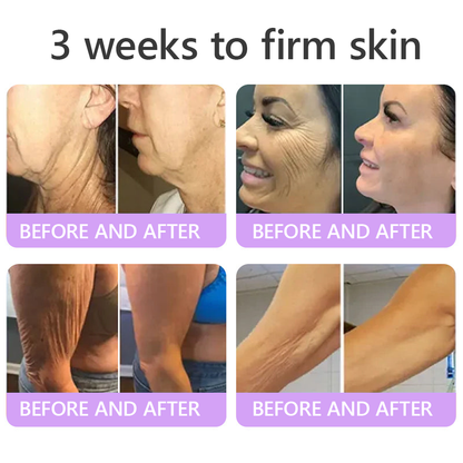 𝑭𝑫𝑨 𝑶𝒇𝒇𝒊𝒄𝒊𝒂𝒍: 𝐇𝐈𝐒𝐊𝐈𝐍® 𝑷𝑫𝑹𝑵 𝑴𝒖𝒍𝒕𝒊-𝑷𝒆𝒑𝒕𝒊𝒅𝒆 𝑴𝒂𝒔𝒔𝒂𝒈𝒊𝒏𝒈 𝑩𝒐𝒅𝒚 𝑹𝒐𝒍𝒍𝒆𝒓 𝗖𝗿𝗲𝗮𝗺- 𝗔𝗻𝘁𝗶-𝗮𝗴𝗶𝗻𝗴, 𝗛𝘆𝗱𝗿𝗮𝘁𝗶𝗻𝗴,𝗦𝗸𝗶𝗻 𝗙𝗶𝗿𝗺𝗶𝗻𝗴 & 𝗟𝗶𝗳𝘁𝗶𝗻𝗴, 𝗦𝗸𝗶𝗻 𝗥𝗲𝗽𝗮𝗶𝗿, 𝗘𝘃𝗲𝗻 𝗧𝗼𝗻𝗲, 𝗔𝗰𝗻𝗲 𝗮𝗻𝗱 𝗗𝗮𝗿𝗸 𝗦𝗽𝗼𝘁 𝗧𝗿𝗲𝗮𝘁𝗺𝗲𝗻𝘁, 𝗪𝗮𝗿𝘁 𝗮𝗻𝗱 𝗠𝗼𝗹𝗲 𝗥𝗲𝗺𝗼𝘃𝗮𝗹, 𝗮𝗻𝗱 𝗣𝘀𝗼𝗿𝗶𝗮𝘀𝗶𝘀 𝗥𝗲𝗹𝗶𝗲𝗳.