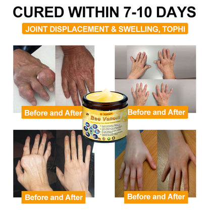 Limited to 10 jars! 🌟𝐋𝐂𝐘𝐒𝐓𝐀𝐑®—Exclusive 30% discount, restore your skin's youthful glow in just 1-3 weeks! A rare opportunity — won’t be available again until next year, don’t miss out!180-day money-back guarantee, full refund with no risk!