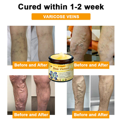 Limited to 10 jars! 🌟𝐋𝐂𝐘𝐒𝐓𝐀𝐑®—Exclusive 30% discount, restore your skin's youthful glow in just 1-3 weeks! A rare opportunity — won’t be available again until next year, don’t miss out!180-day money-back guarantee, full refund with no risk!